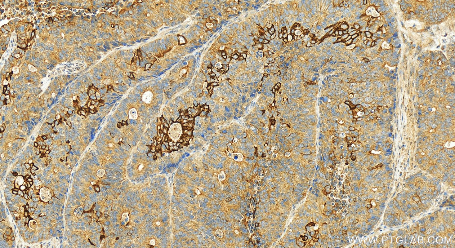 IHC staining of human stomach using 12303-1-AP