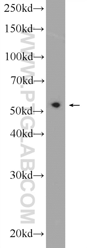 WB analysis of HeLa using 12485-1-AP