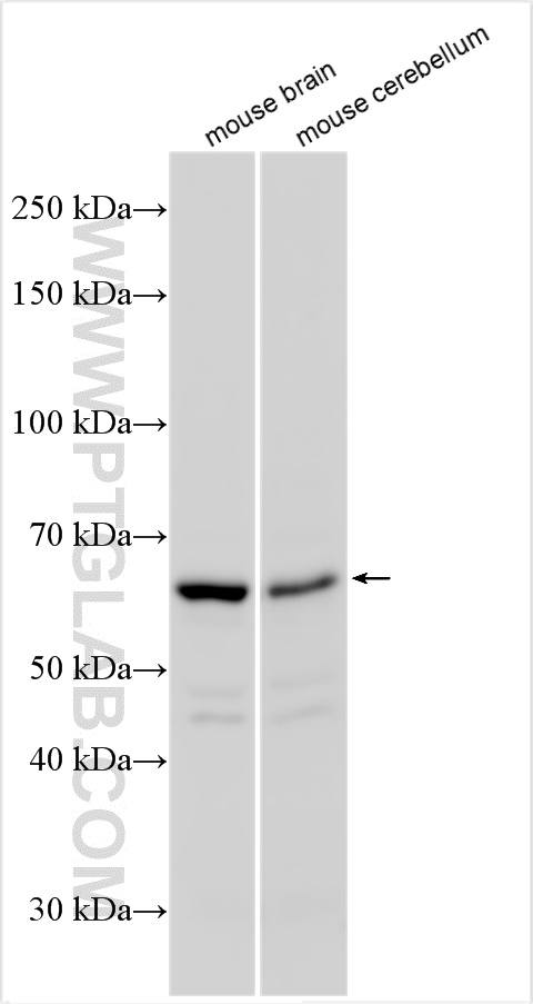 WB analysis using 13121-1-AP