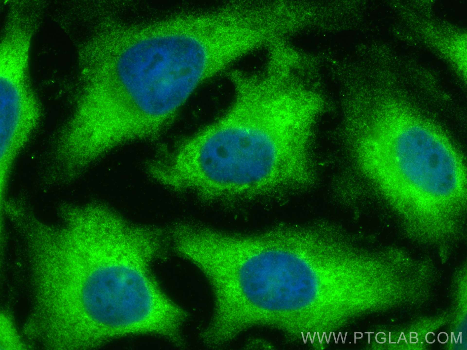 IF Staining of HeLa using 12918-1-AP