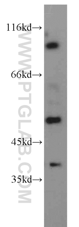 WB analysis of Y79 using 55183-1-AP