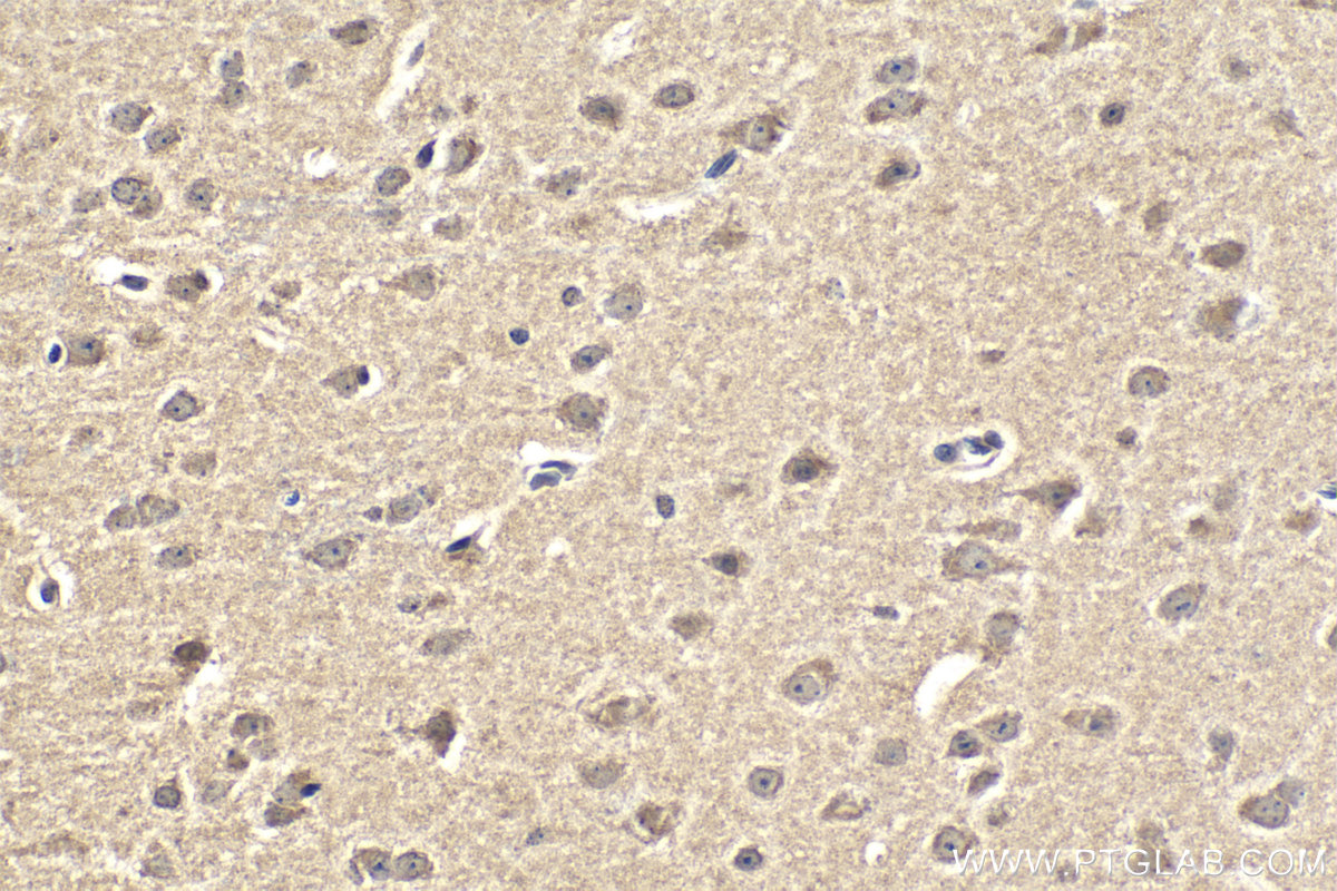 IHC staining of mouse brain using 67565-1-Ig (same clone as 67565-1-PBS)