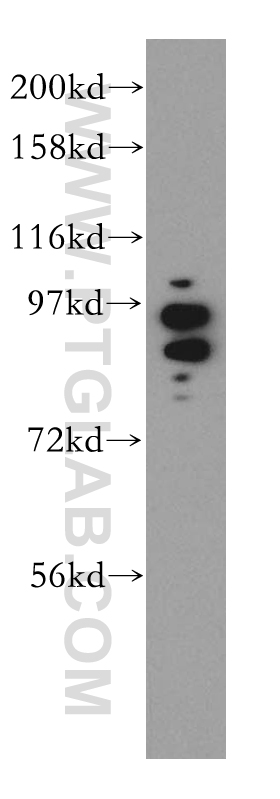 WB analysis of mouse testis using 13956-1-AP