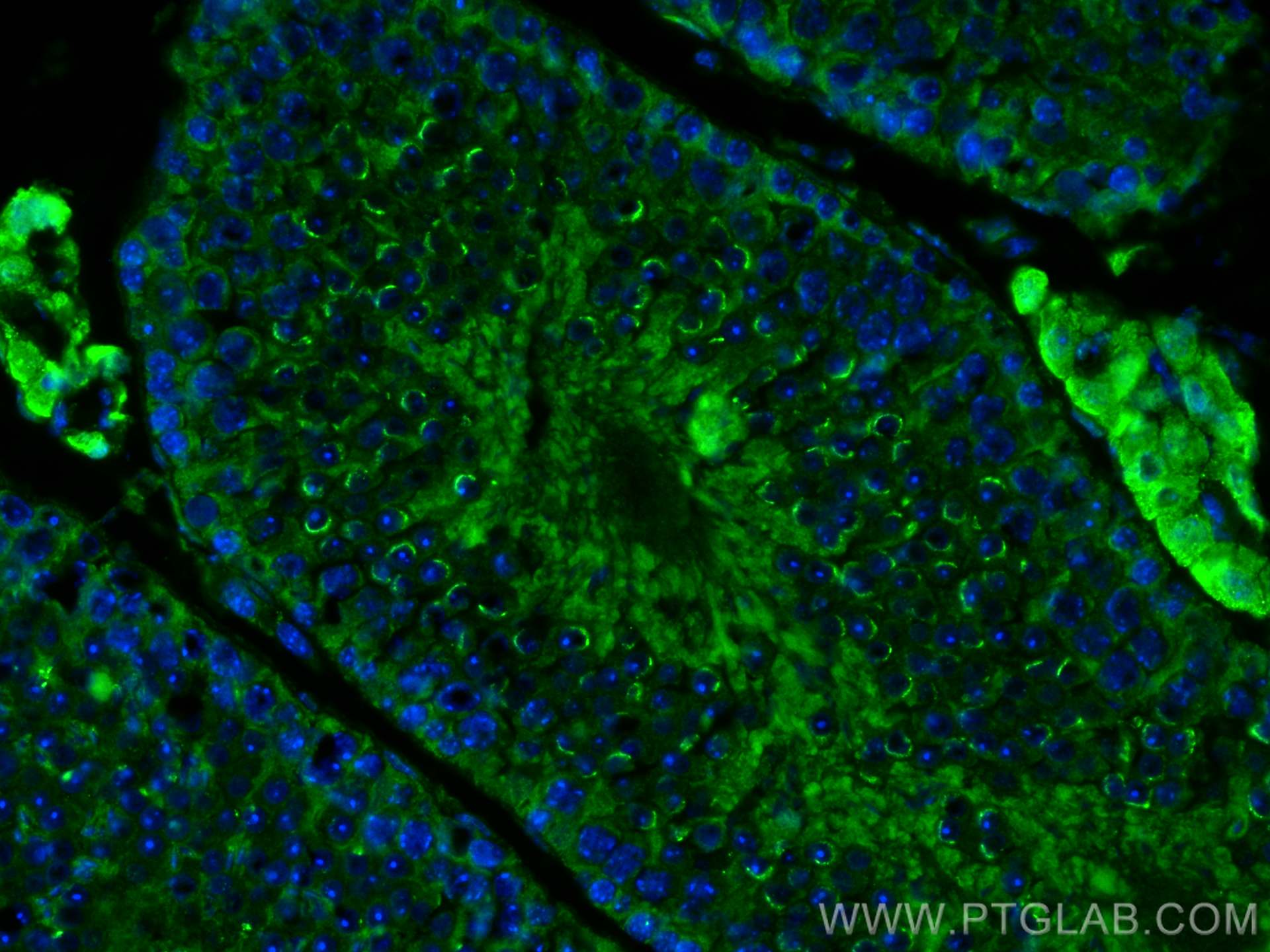 IF Staining of mouse testis using 30708-1-AP