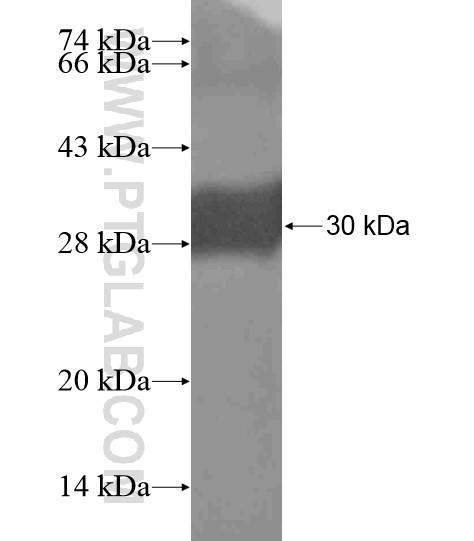 PDE8B fusion protein Ag19415 SDS-PAGE