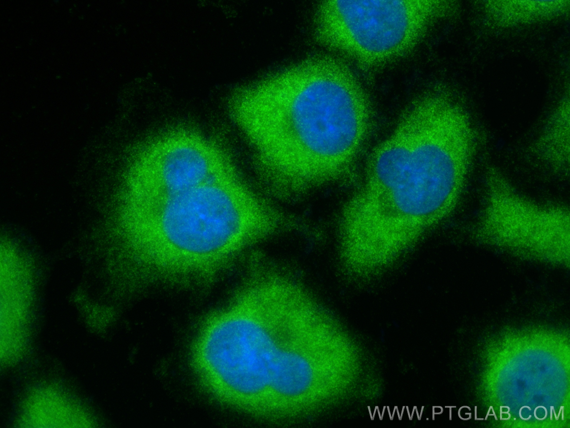 IF Staining of A549 using 12648-1-AP