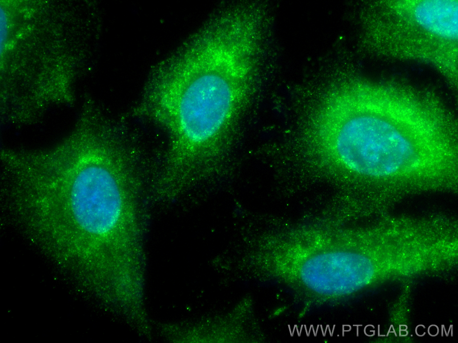 IF Staining of A549 using 14075-1-AP