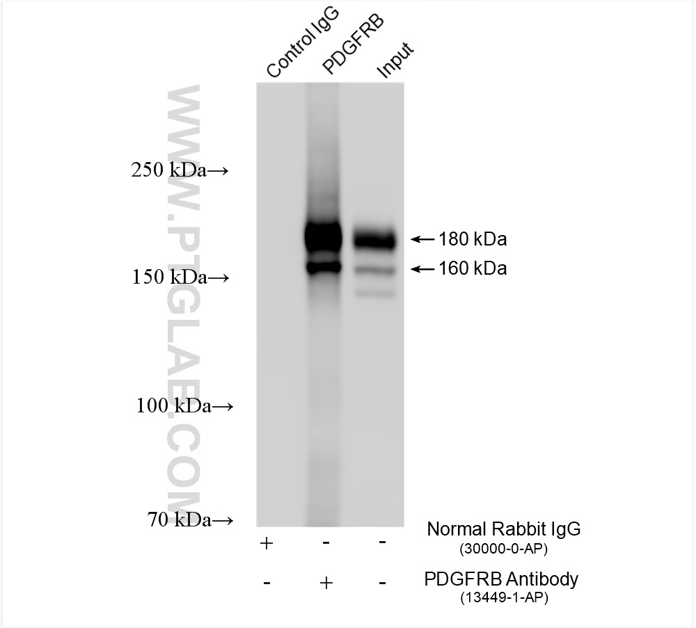 IP experiment of mouse lung using 13449-1-AP