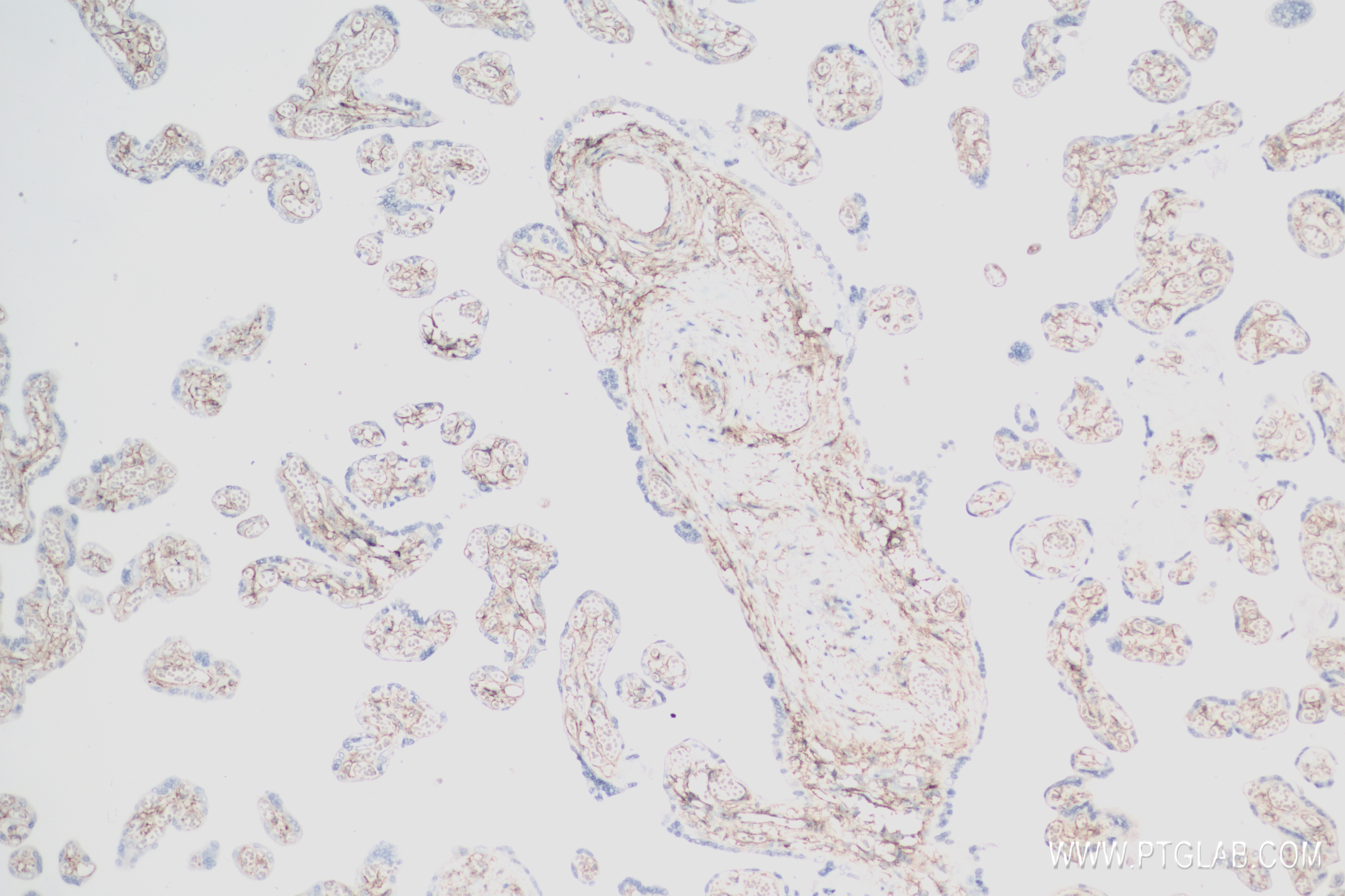 IHC staining of human placenta using 82943-1-RR