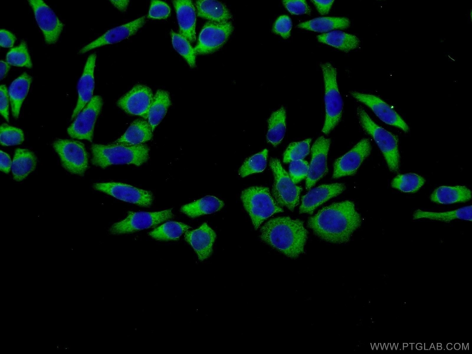 IF Staining of L02 using 16217-1-AP