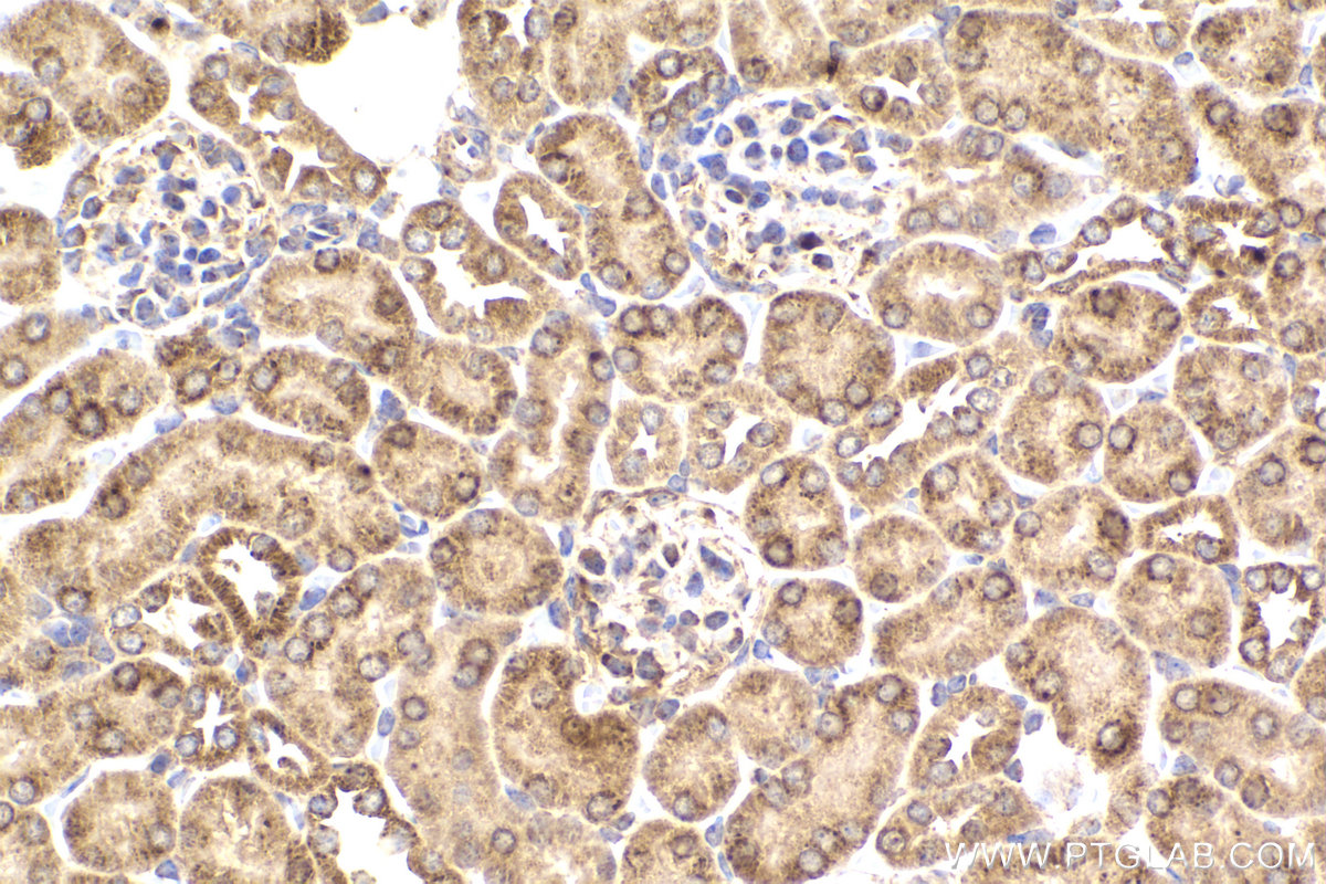 IHC staining of mouse kidney using 68238-1-Ig