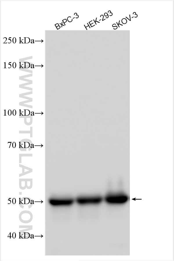 WB analysis using 10951-1-AP