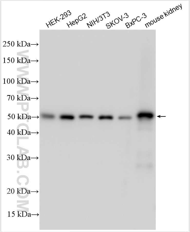 WB analysis using 10951-1-AP