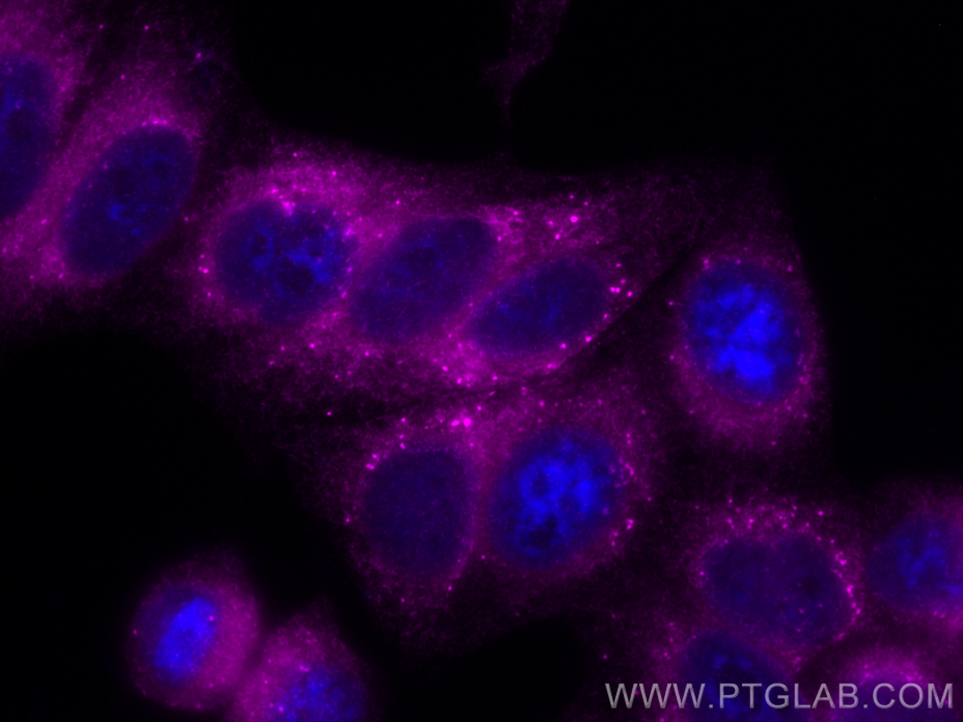 IF Staining of HepG2 using CL647-11245