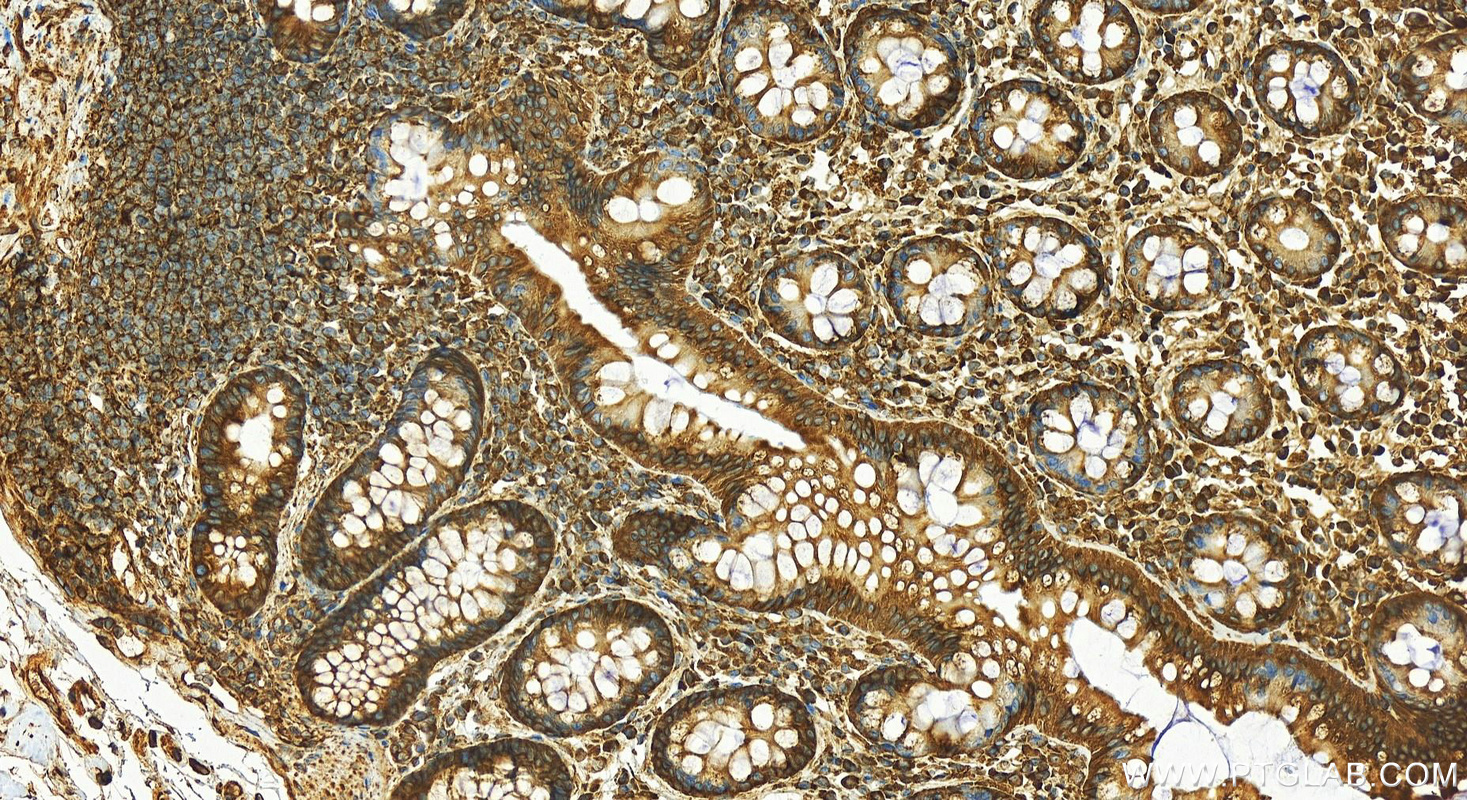 IHC staining of human normal colon using 15967-1-AP