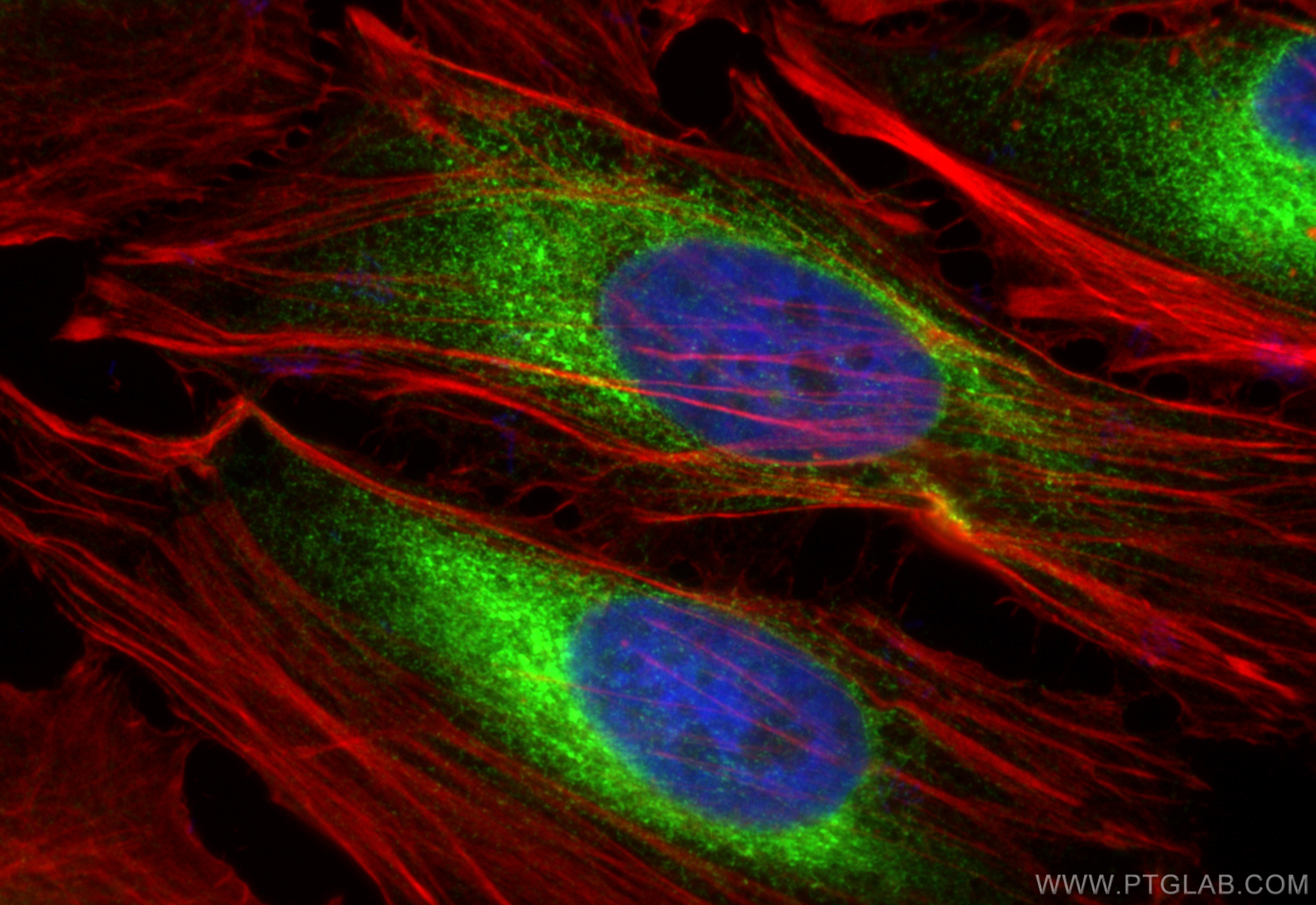 IF Staining of HeLa using 18233-1-AP