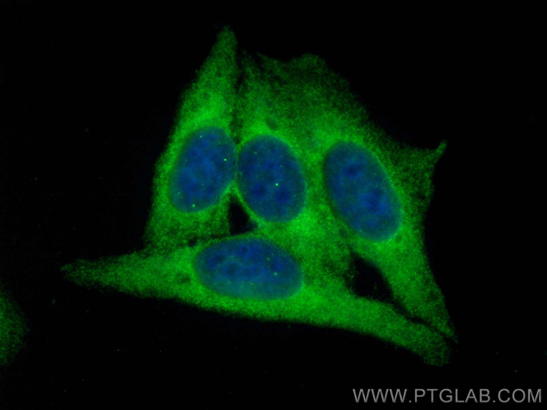 IF Staining of HepG2 using 66669-1-Ig (same clone as 66669-1-PBS)