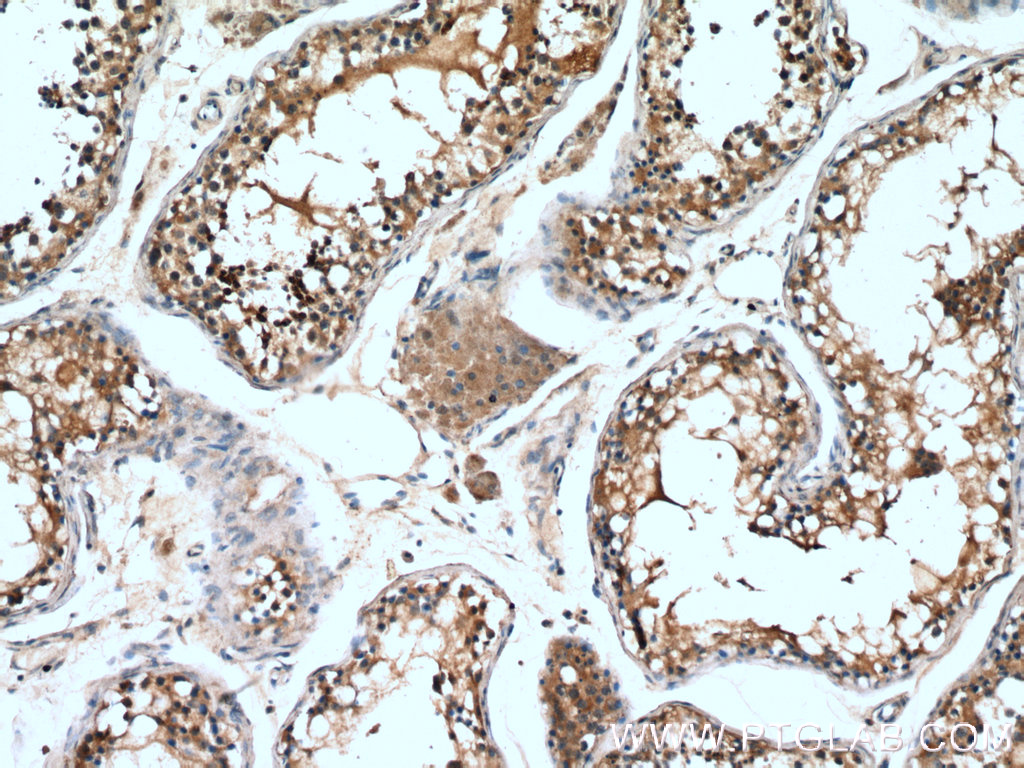 IHC staining of human testis using 26305-1-AP