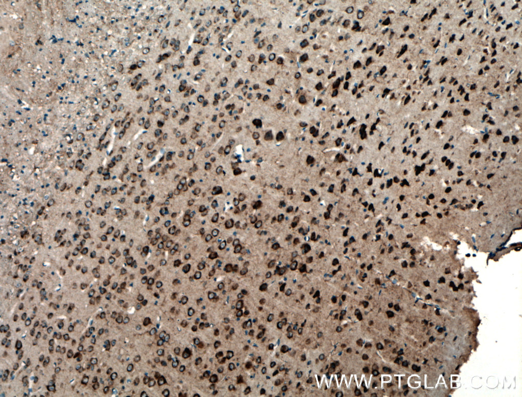 IHC staining of mouse brain using 15647-1-AP