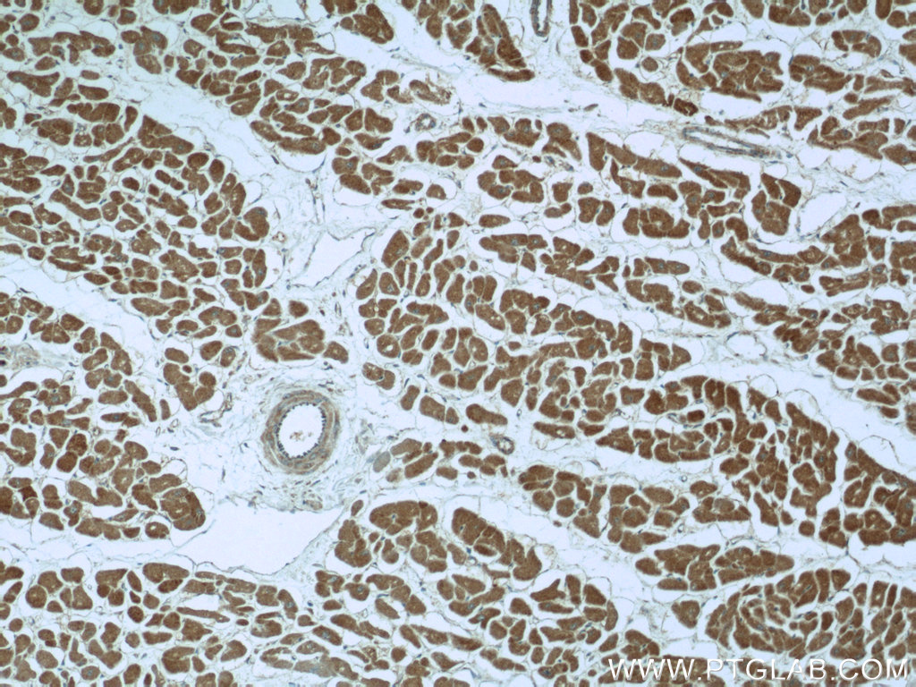 IHC staining of human heart using 12215-1-AP