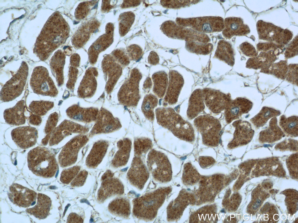 IHC staining of human heart using 12215-1-AP