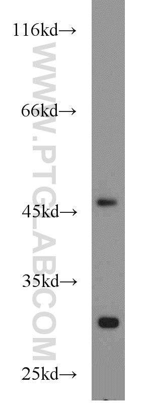 WB analysis of mouse heart using 12215-1-AP