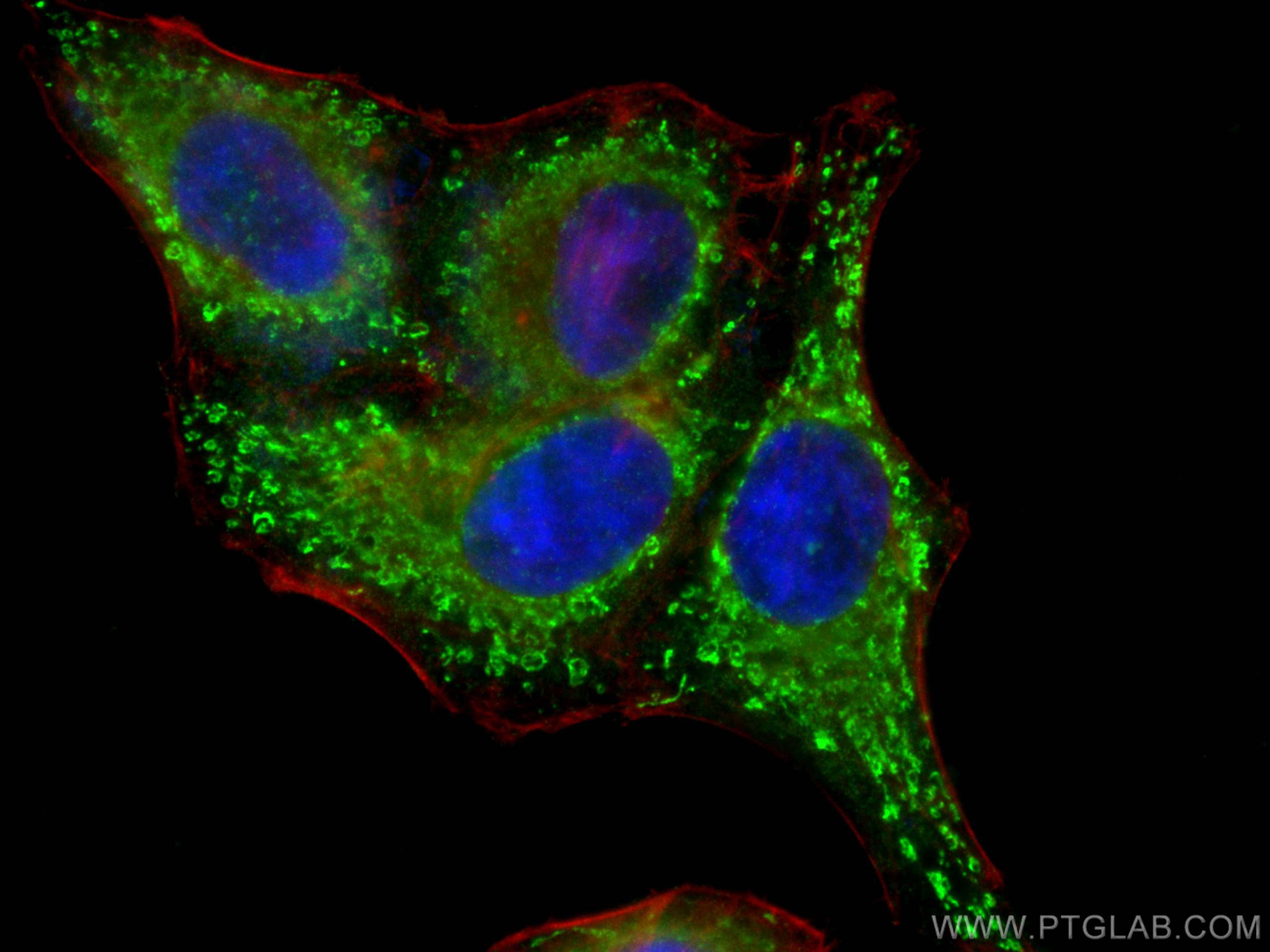 IF Staining of HepG2 using 12949-1-AP