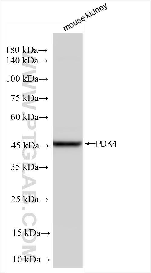 WB analysis of mouse kidney using 83583-1-RR