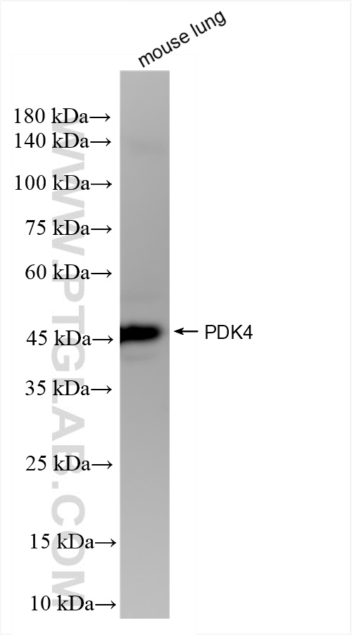 PDK4