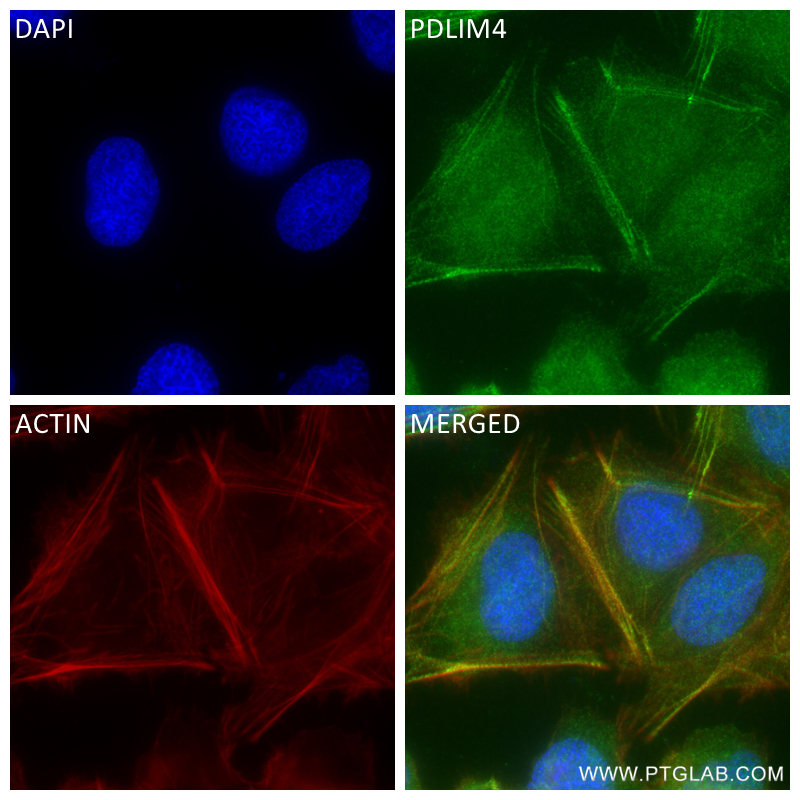 IF Staining of U2OS using 84117-1-RR