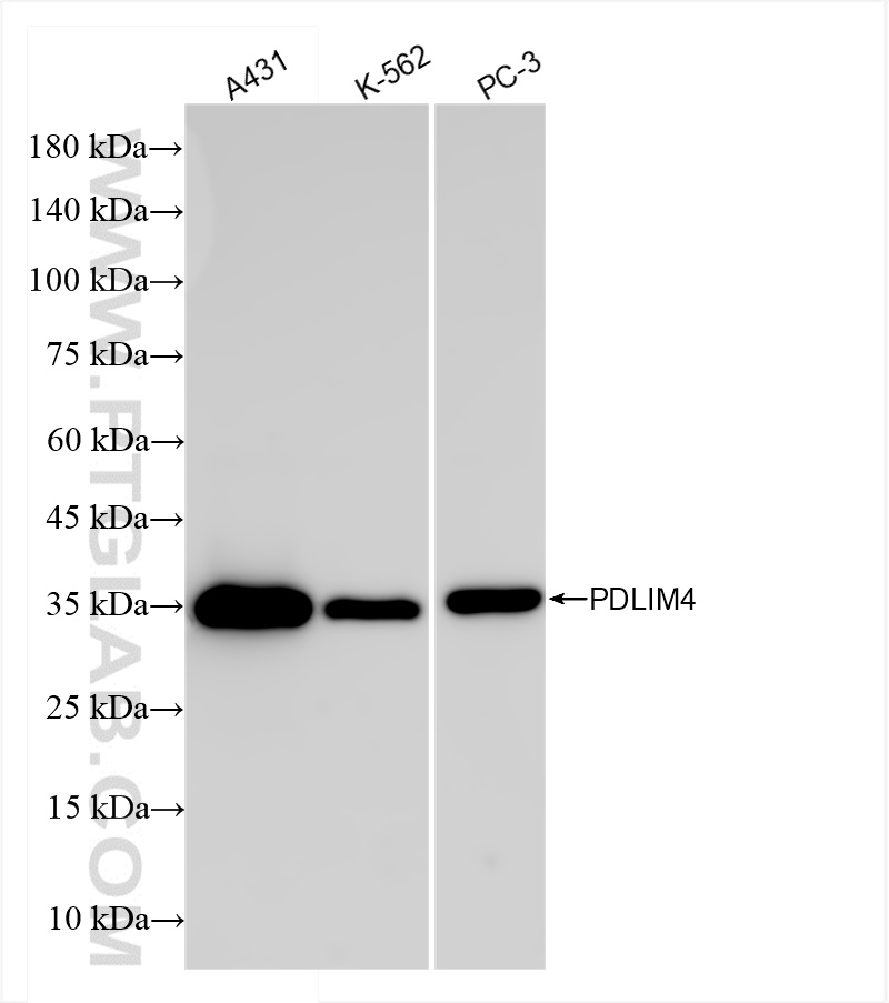 WB analysis using 84117-1-RR (same clone as 84117-1-PBS)