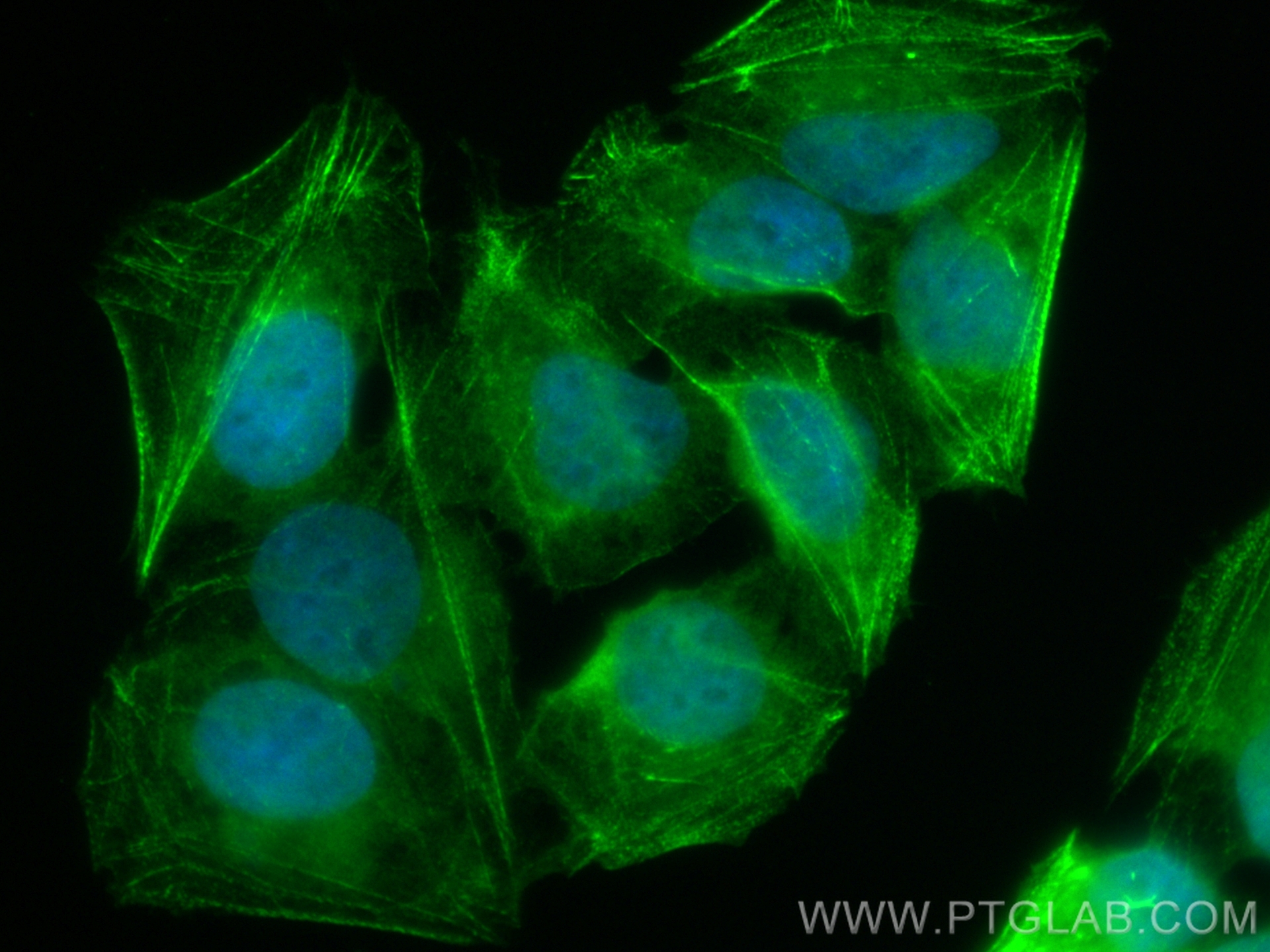 IF Staining of U2OS using CL488-84117