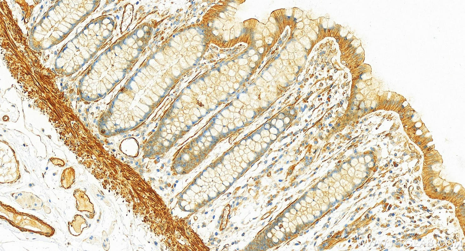 IHC staining of human colon using 10221-1-AP