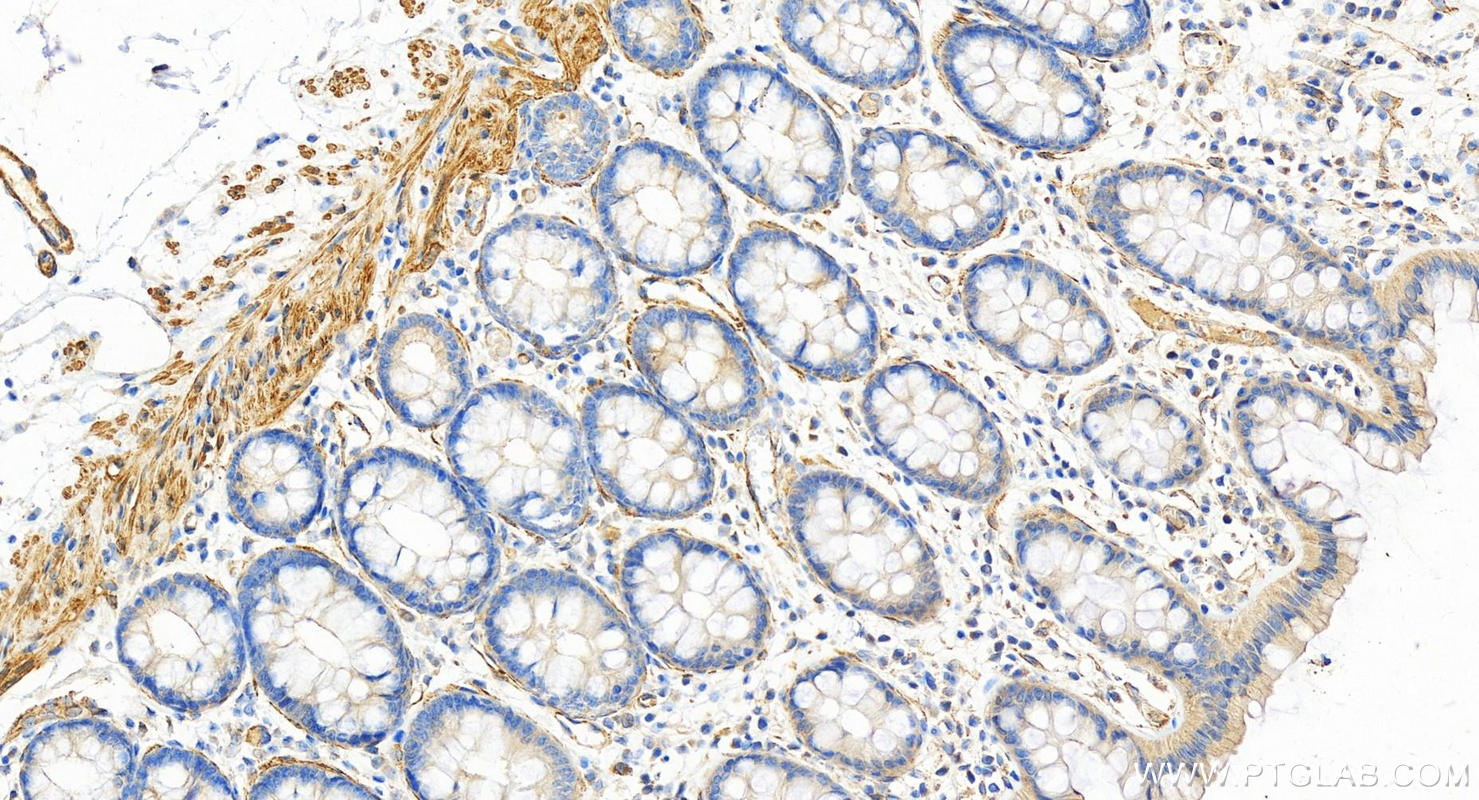 IHC staining of human  colon using 17080-1-AP