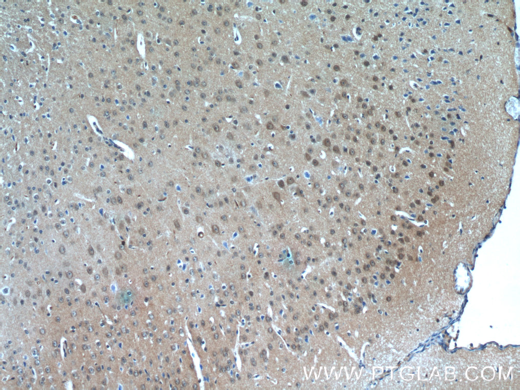 IHC staining of mouse brain using 13404-1-AP