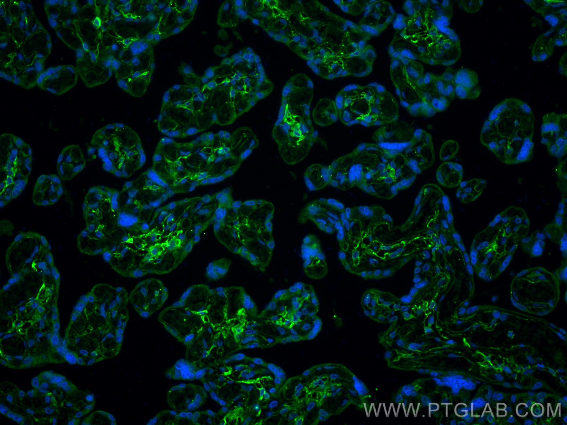 IF Staining of human placenta using 11629-1-AP