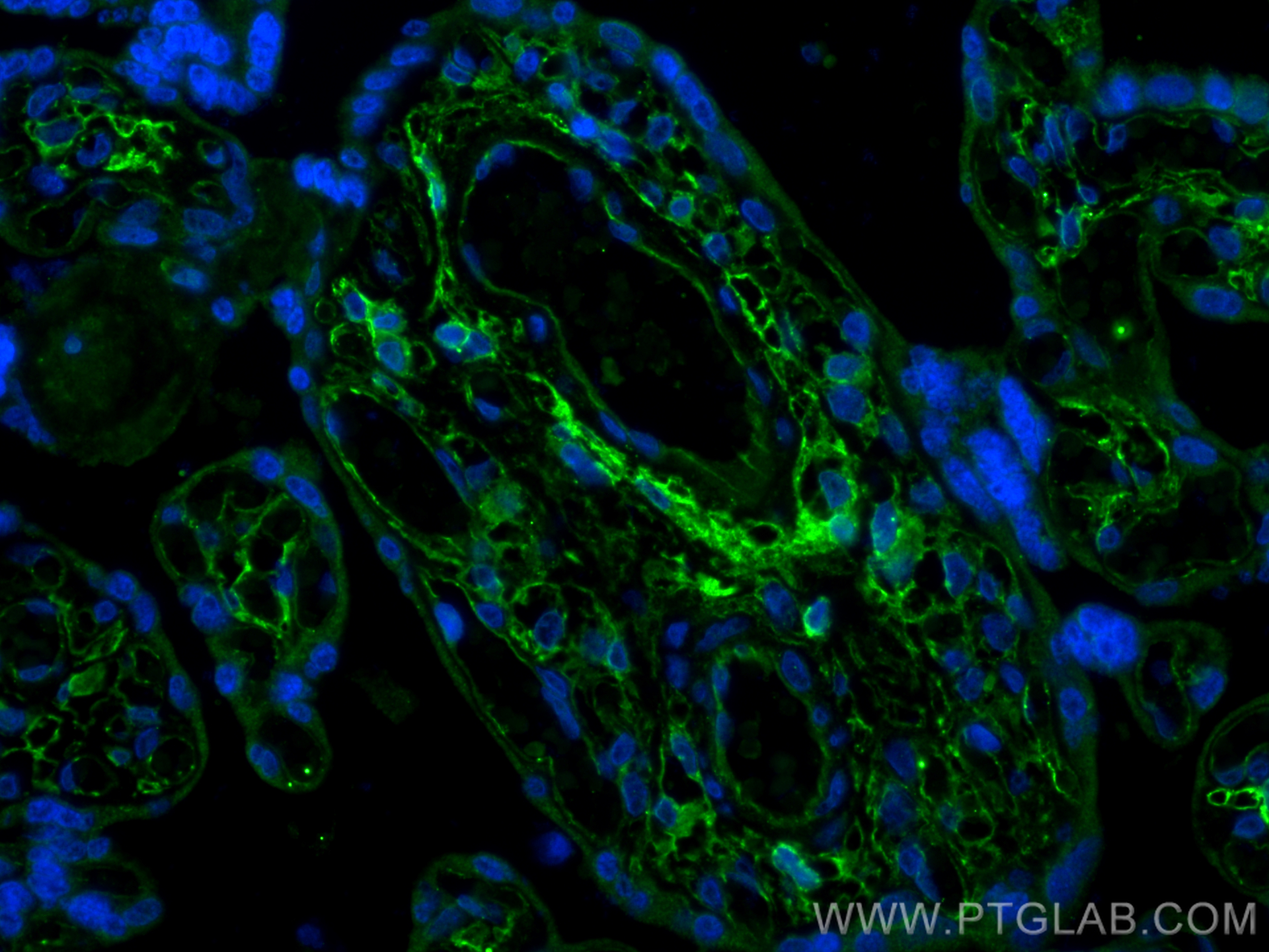 IF Staining of human placenta using 11629-1-AP