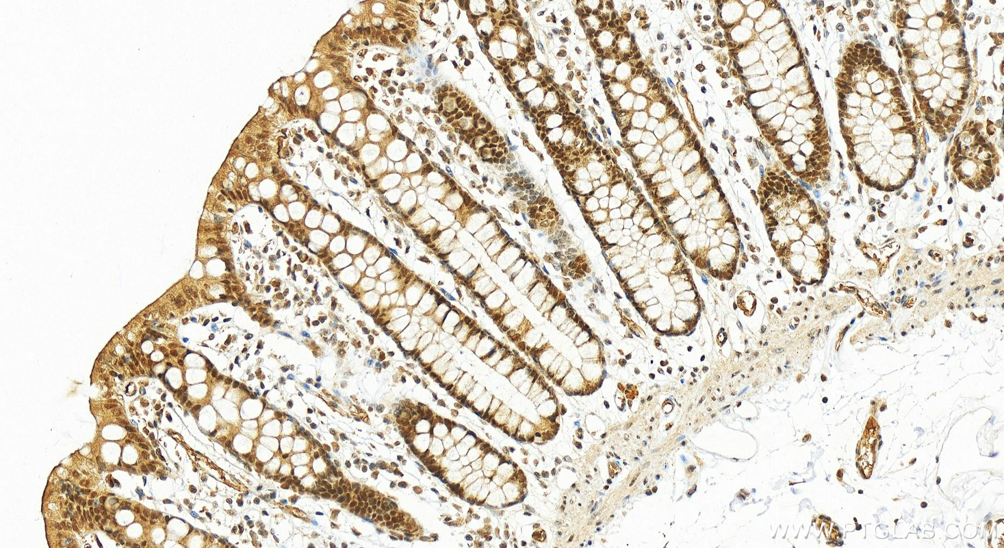 IHC staining of human colon using 17485-1-AP