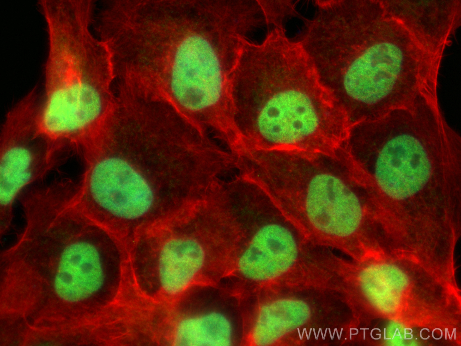 IF Staining of A431 using 17485-1-AP