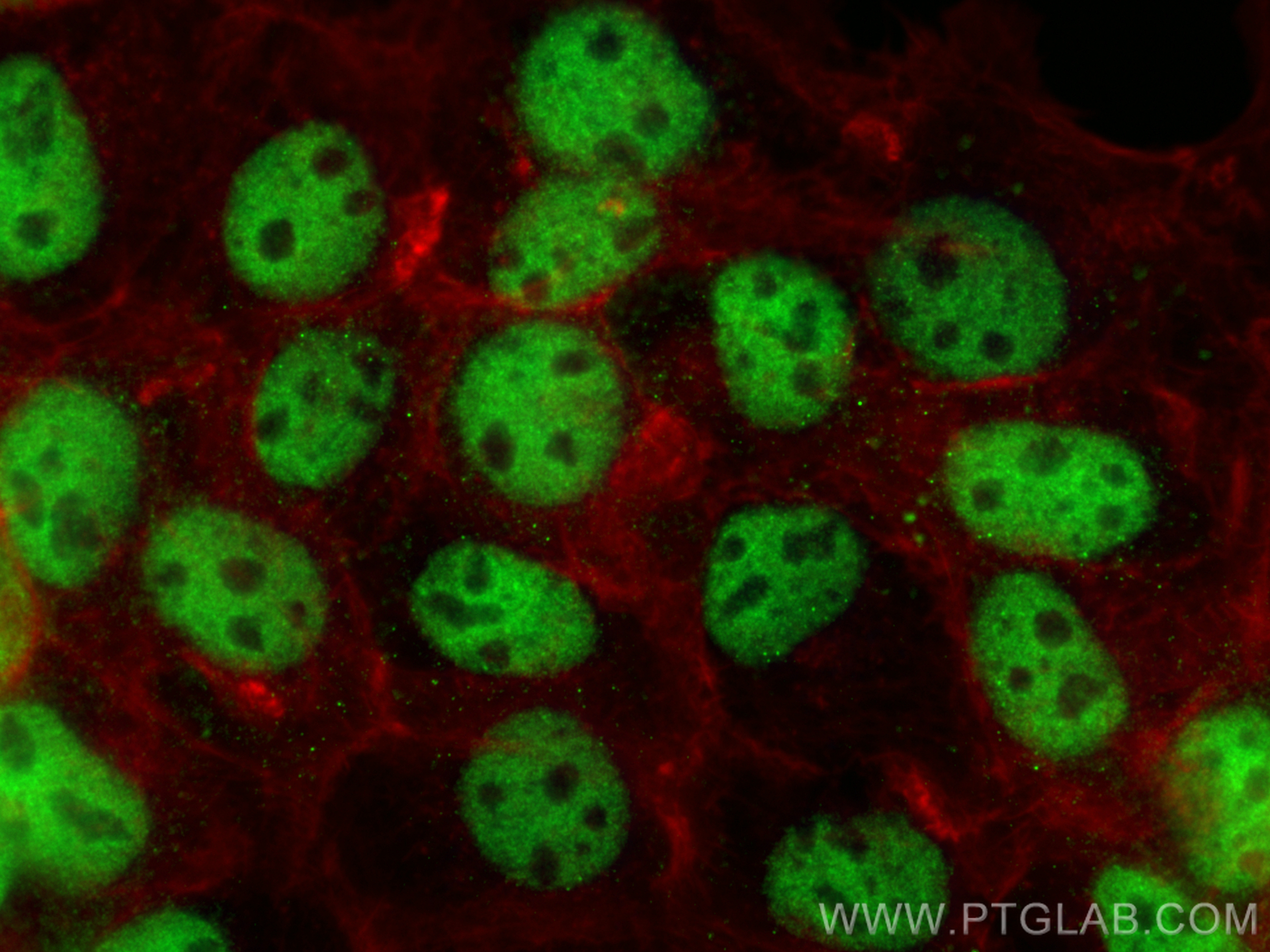 IF Staining of A431 using 67520-1-Ig