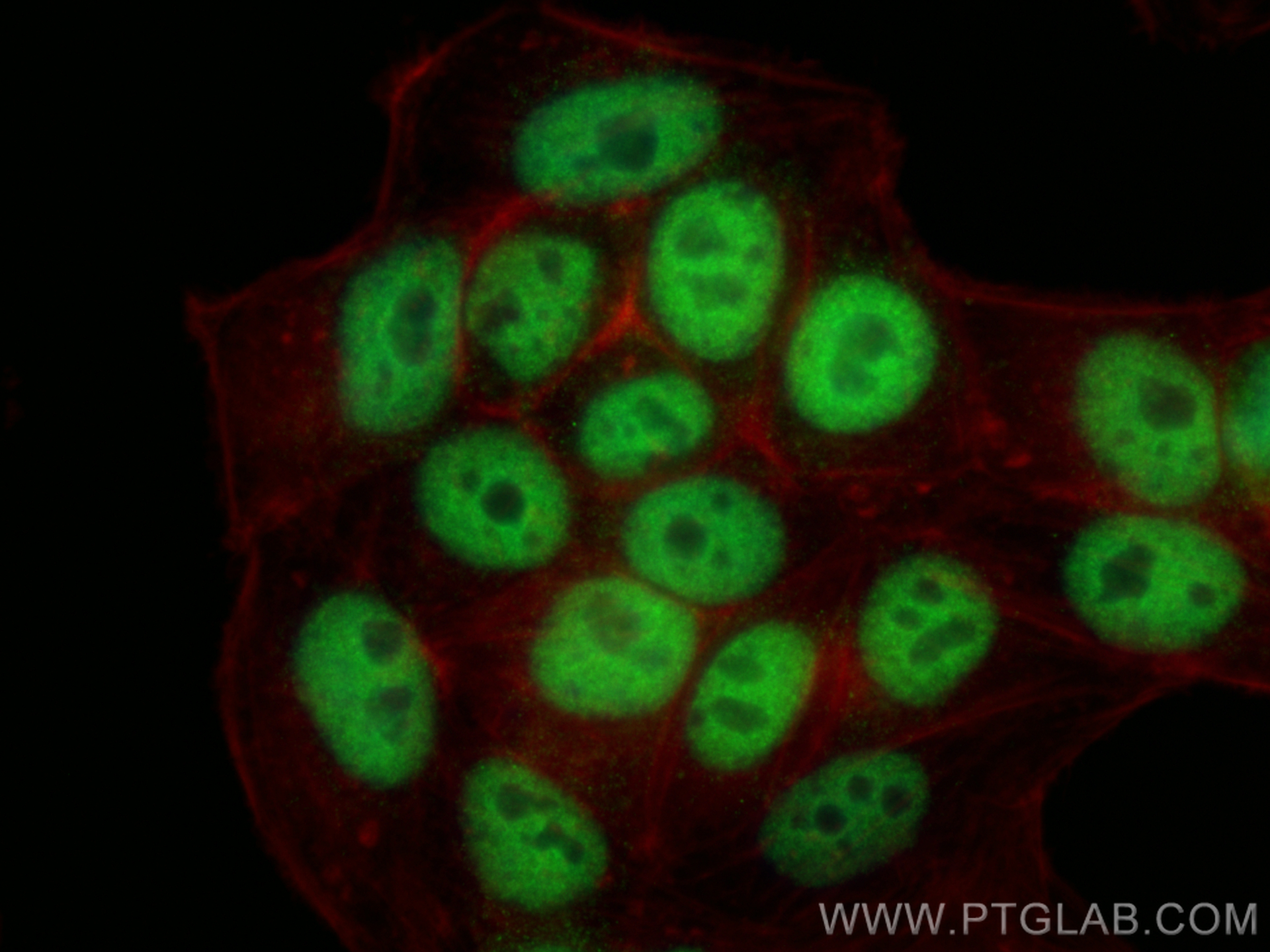 IF Staining of HepG2 using 67520-1-Ig