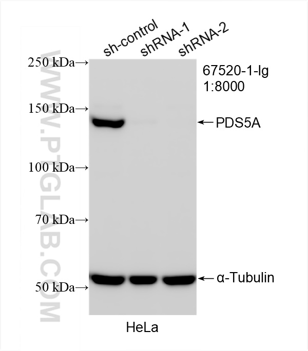 WB analysis of HeLa using 67520-1-Ig