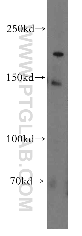 WB analysis of HT-1080 using 18796-1-AP