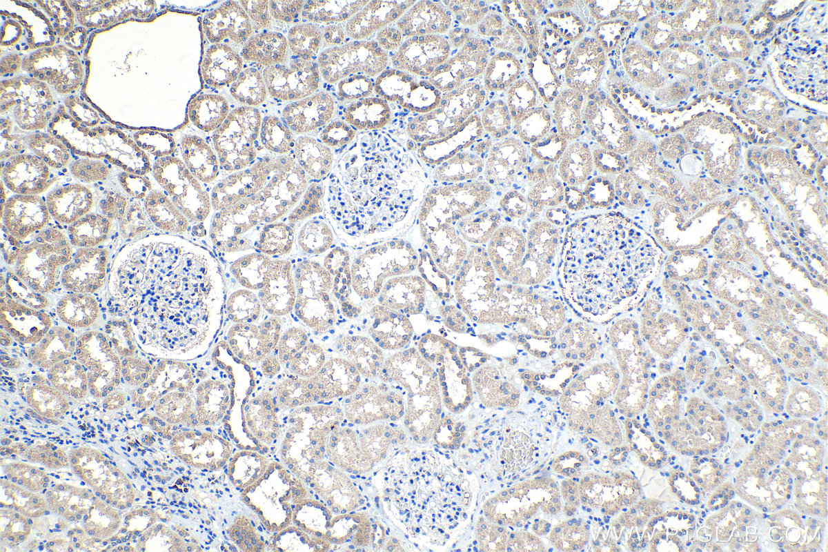 IHC staining of human kidney using 13544-1-AP