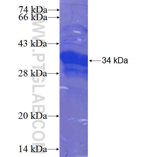 PDZD11 fusion protein Ag23975 SDS-PAGE