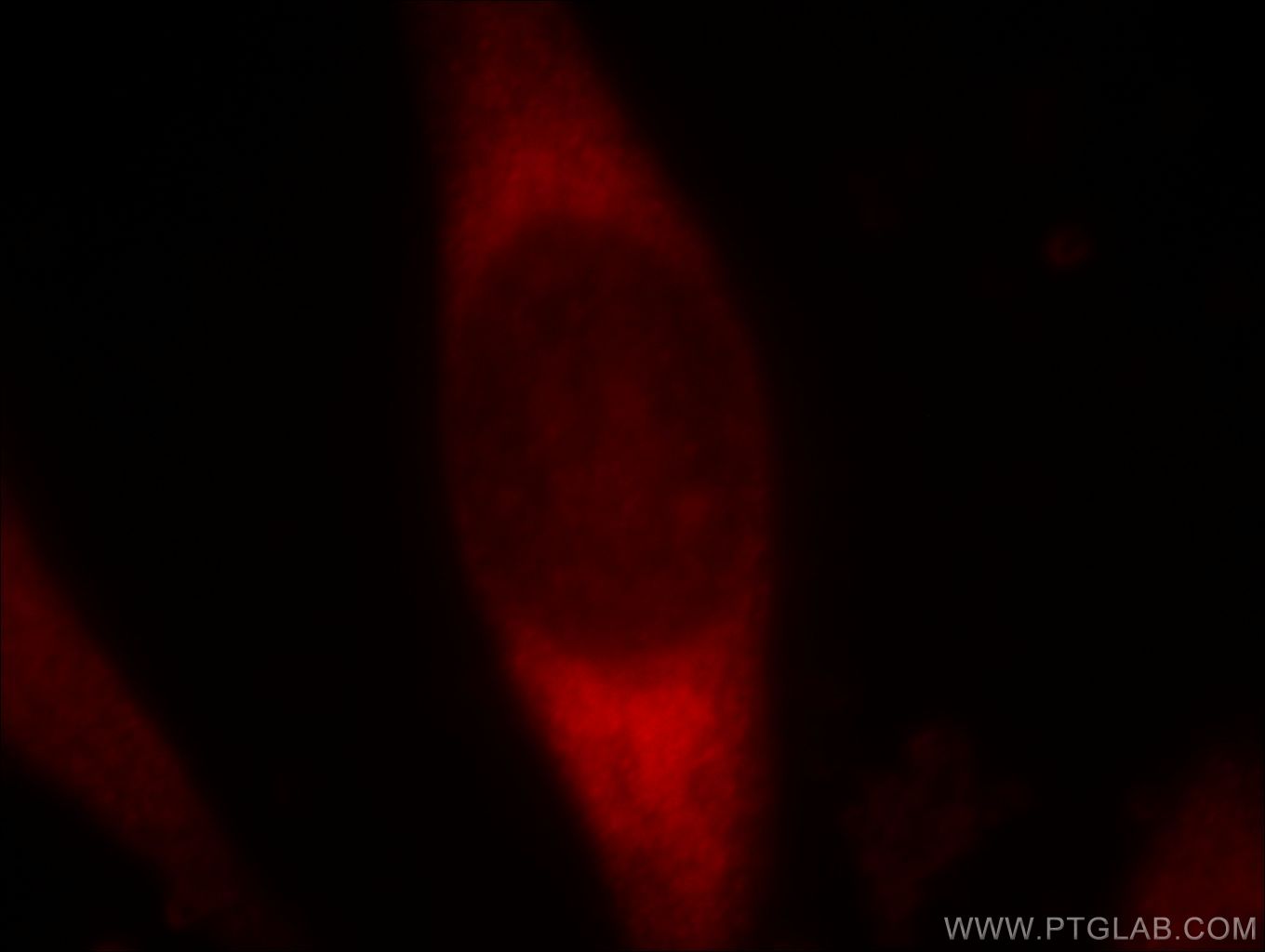 IF Staining of HeLa using 20039-1-AP