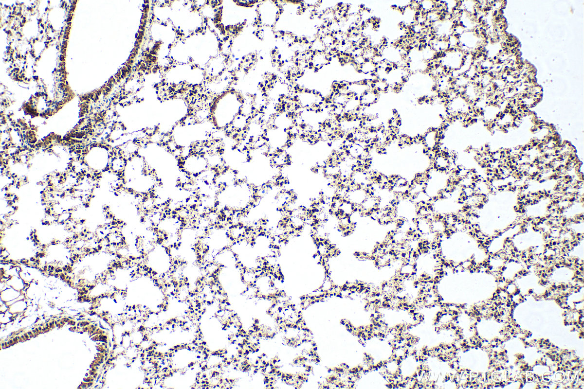 IHC staining of mouse lung using 30191-1-AP