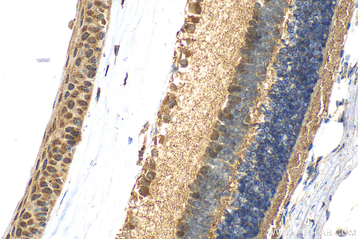 IHC staining of mouse eye using 21084-1-AP