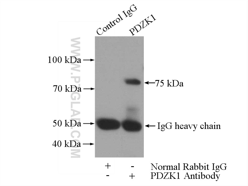 IP experiment of HEK-293 using 10507-2-AP