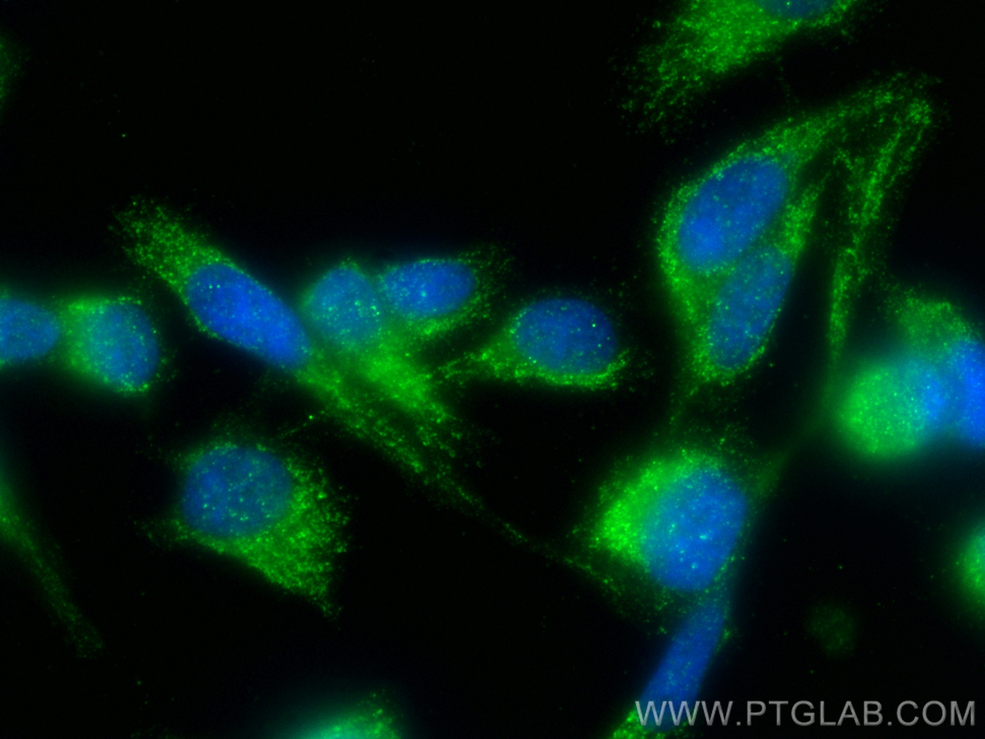 IF Staining of PC-3 using 12518-1-AP (same clone as 12518-1-PBS)